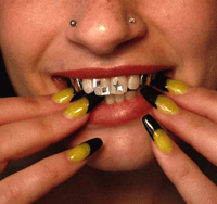 Star Tooth Gem Kit
