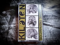 Image 2 of Kiloton "Neolithic Trepanation" MC