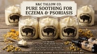 RENEW RESTORE WHIPPED 4oz for eczema-prone skin