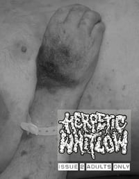 Image 2 of Herpetic Whitlow Zine