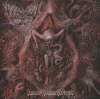 Vulvectomy-aberrant vaginal gestation cd