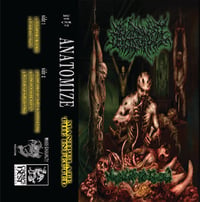 ANATOMIZE 'MANIPULATE THE INFECTED' CASSETTE