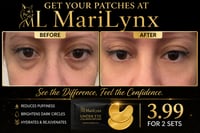 Image 2 of Under eye collagen patches
