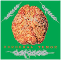 Carcass - Cerebral Tumor: Live In Dortmund, Germany, 30/07/90 2x12" (European Import)