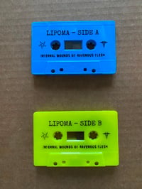 Image 2 of Infernal Wounds of Ravenous Flesh Cassette Tape