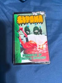 Image 1 of Mysteries of Surgical Oncology Cassete ****SOUL CASKET RECORDS HAS COPIES***