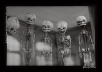 Image 1 of Infants