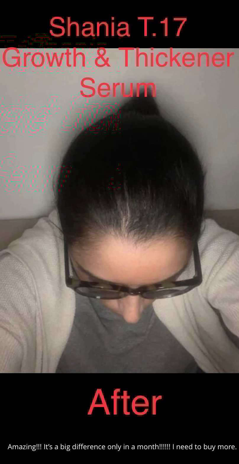 Image of Shania T.17  Growth and Thickener Hair Oil with Serum 8 Fl.oz 