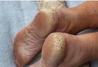 Image 6 of EXTREME SALTY FEET SOAK & SCRUB & EXTREME FOOT CREAM