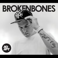 Broken Bones EP - SIGNED