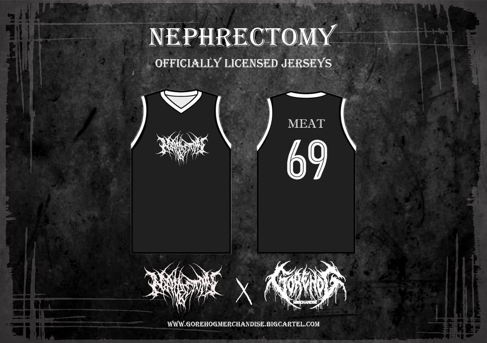 Nephrectomy Jerseys(version white)