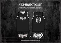 Image 1 of Nephrectomy Jerseys(version white)