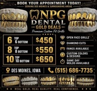 Image 5 of 12 top and 12-bottom-NPG SOLID GOLD GRILL