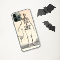 Image 5 of Antique Bookpage Detailed Anatomical Illustration Human and Bird Skeletons Clear Case for iPhone®