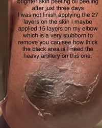 Image 4 of “BRIGHTER SKIN” PEELING OIL 