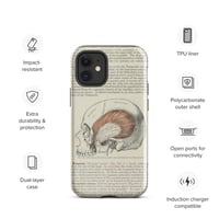 Image 5 of Antique Bookpage Detailed Anatomical Illustration Human Skull Tough Case for iPhone®