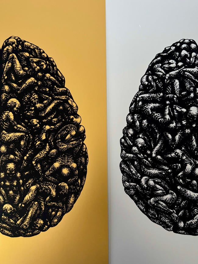 Brain Death Gold