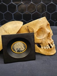 Image 1 of ANTIQUE ANATOMICAL COLLECTION - Preserved web-HEAD