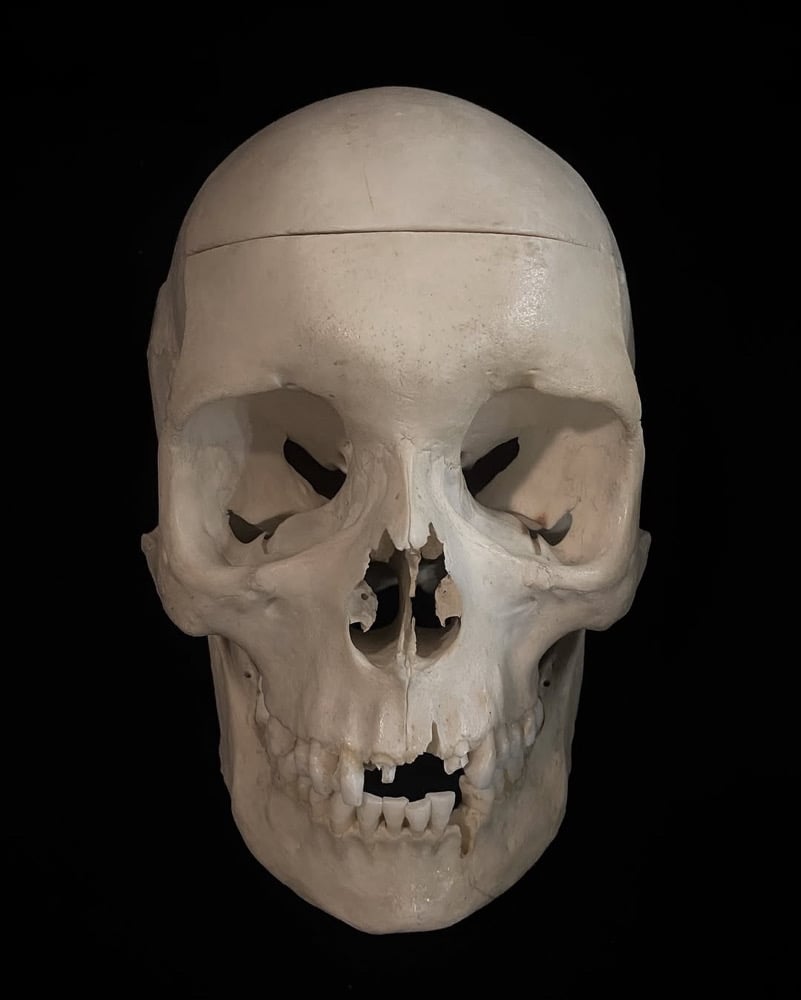 Image of Human Skull