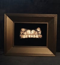 Image 1 of Before Braces - Original Beadwork