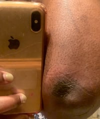 Image 6 of “BRIGHTER SKIN” PEELING OIL 