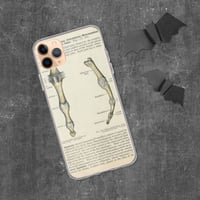 Image 2 of Antique Bookpage Detailed Anatomical Illustration Finger Bones Clear Case for iPhone®