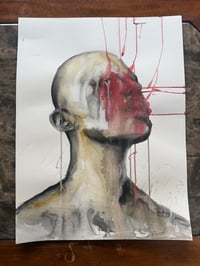 The pain is growing (original)