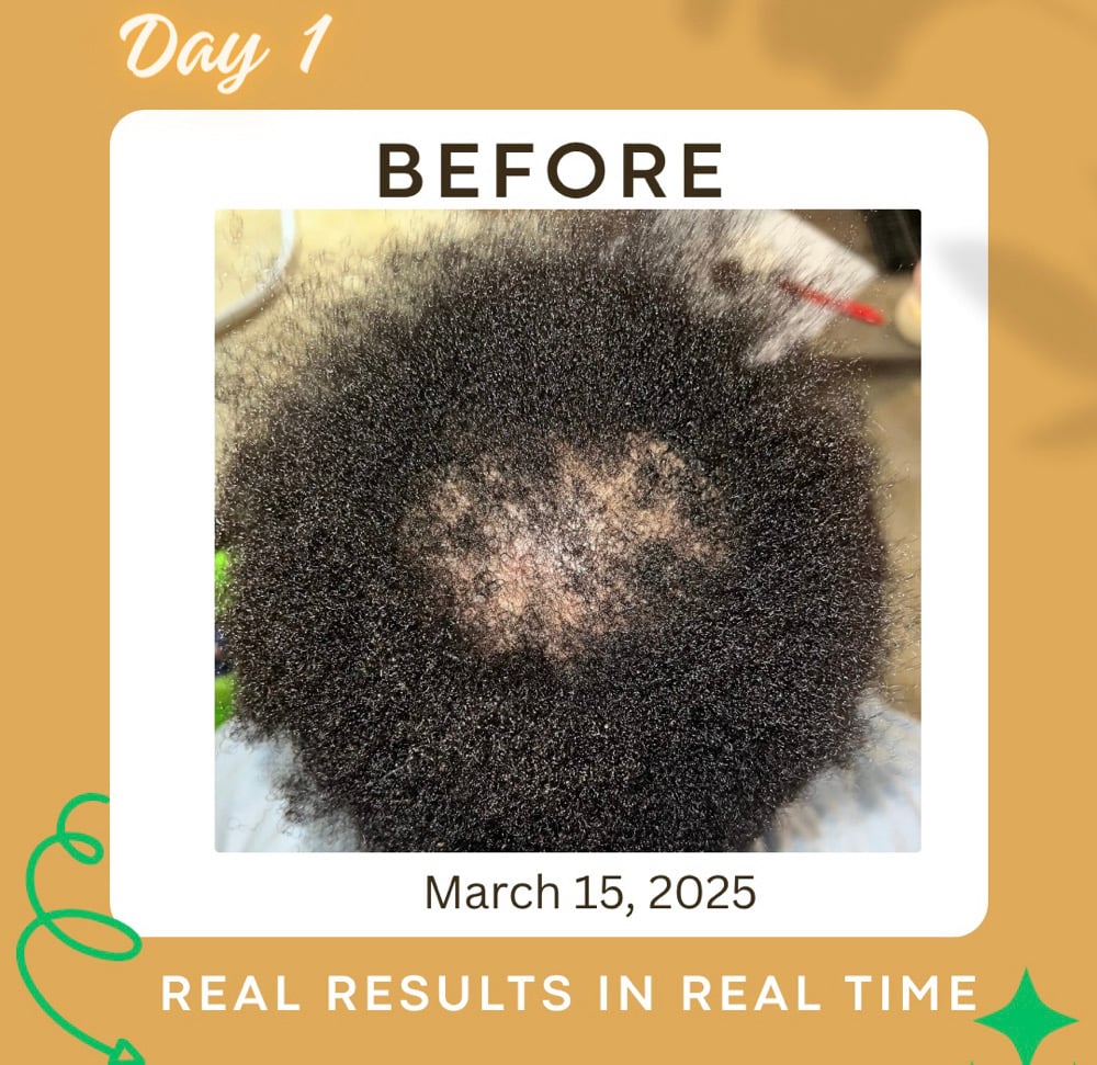 Image of All Natural Hair Growth Oil