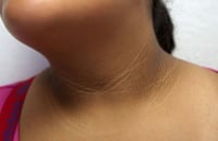 Image 8 of ROSEMARY SKIN BRIGHTENING INNER THIGH CREAM, “SLATE” SKIN BRIGHTENING EXFOLIATING SUGAR SCRUB