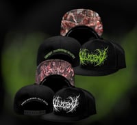 Image 1 of Vulvectomy (snapback)