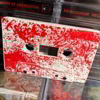Image 5 of Patologicum - "Hecatomb of Aberration" cassette