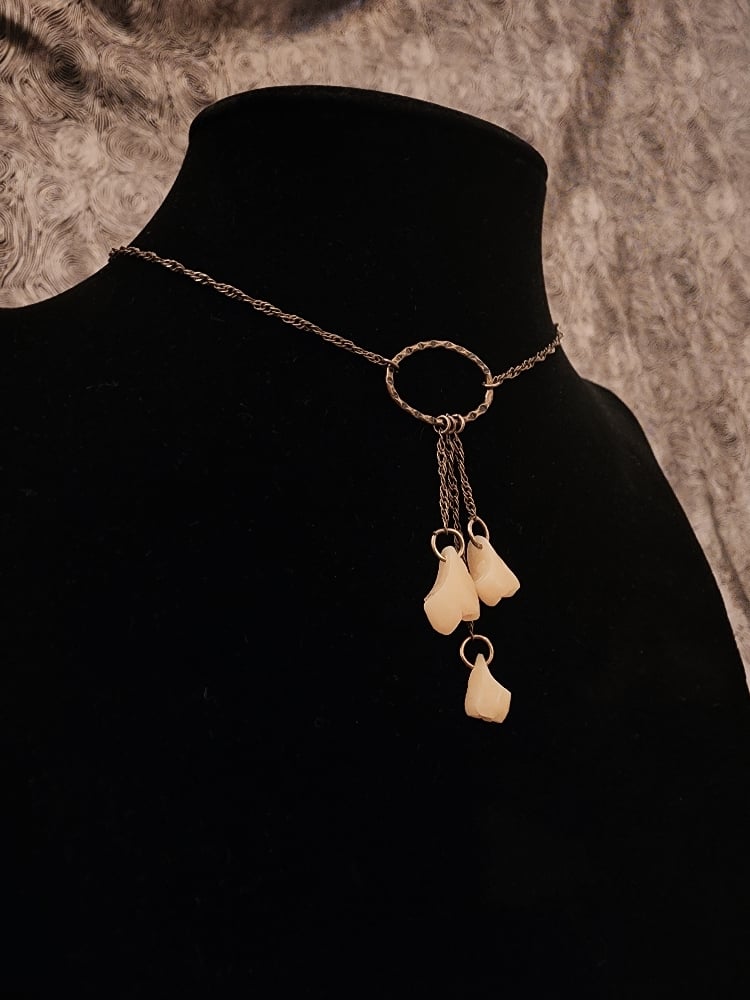 Image of teeth choker