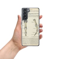 Image 5 of Antique Anatomical Drawing Bones Of The Finger Clear Case for Samsung®