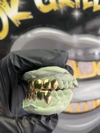 Image 2 of 18k Gold per tooth 