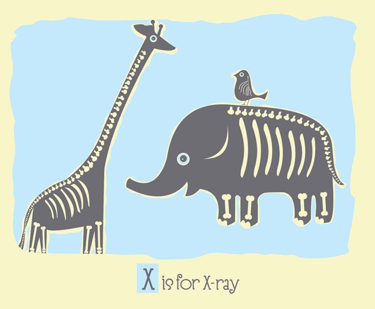 Image of X is for X-ray Alphabet Nursery Print