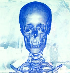 Image of "Studies of a Skull"- Face View, LIMITED EDITION Screen Print Anatomical Lowbrow Art, C.T scan 