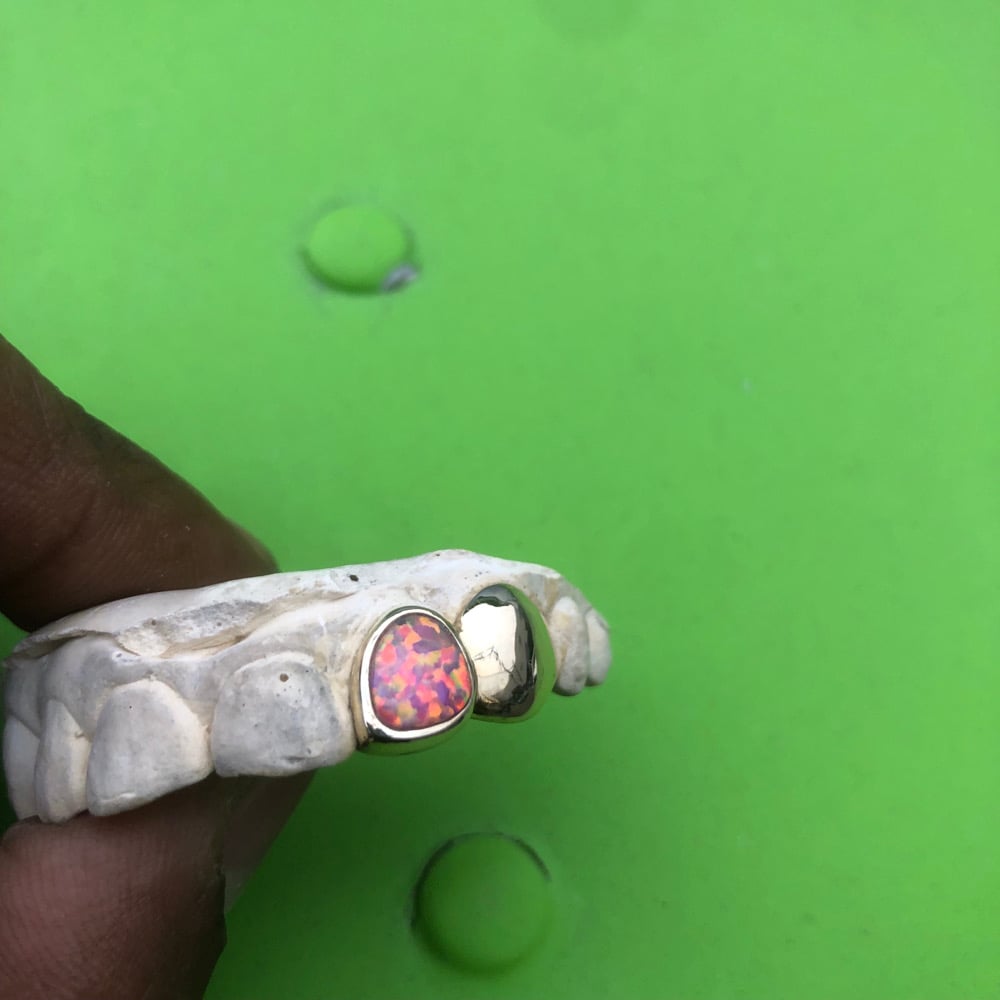 Image of 2 teeth grillz with one Opal 10k yellow gold 