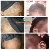 Root Juice Scalp Fertilizer 2oz