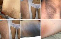 Image 4 of ROSEMARY SKIN BRIGHTENING INNER THIGH CREAM, “SLATE” SKIN BRIGHTENING EXFOLIATING SUGAR SCRUB