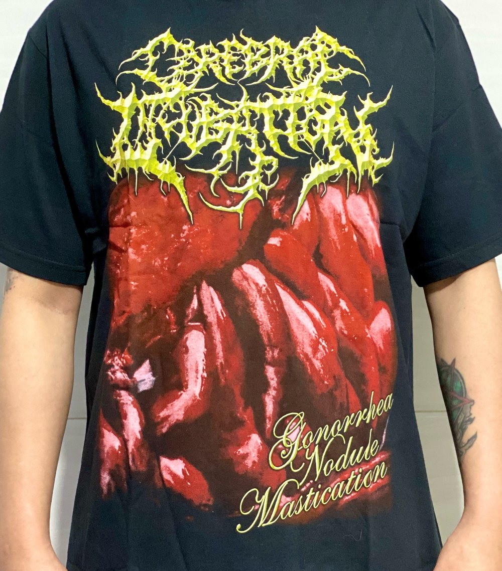 Pathology / Putrid Pile / Cerebral Incubation / Pyaemia 