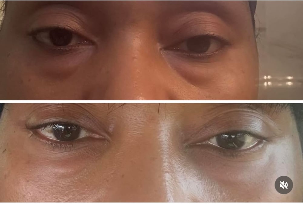 Image of Bags Be Gone Eye Serum 