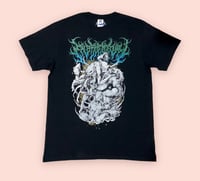 Image 2 of Embryectomy - Version 2