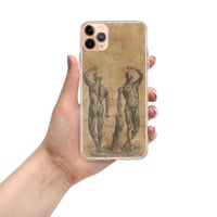 Image 2 of Antique Anatomical Illustration Human Muscular System Clear Case for iPhone®