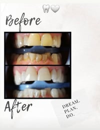 Image 3 of Smile Now - Pay Later