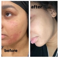 Image 3 of Turmeric Tangerine Lemon Facial Bar (PRE ORDER APRIL 16th RESTOCK)