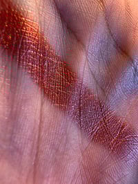 Image 3 of Acid Burn