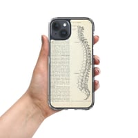 Image 13 of Vintage Book Page Anatomical Illustration Human Spine Clear Case for iPhone®