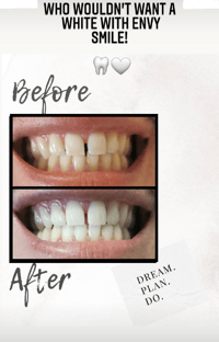 Image 2 of Smile Now - Pay Later