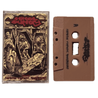 Image 1 of GENERAL SURGERY - “Formitive Forensic Transgressions” cassette