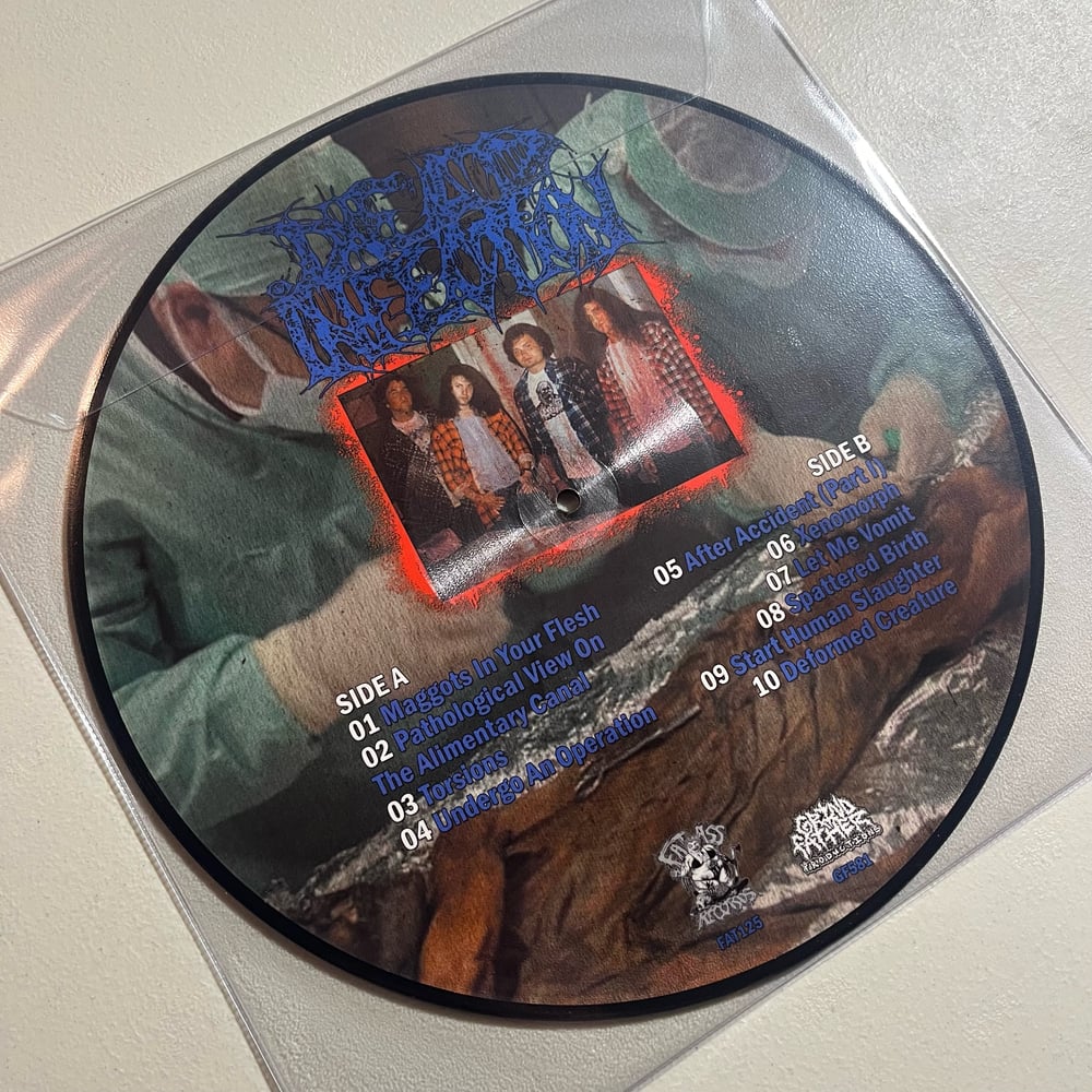 DEAD INFECTION - "Surgical Disembowelment" 12" vinyl picture disc